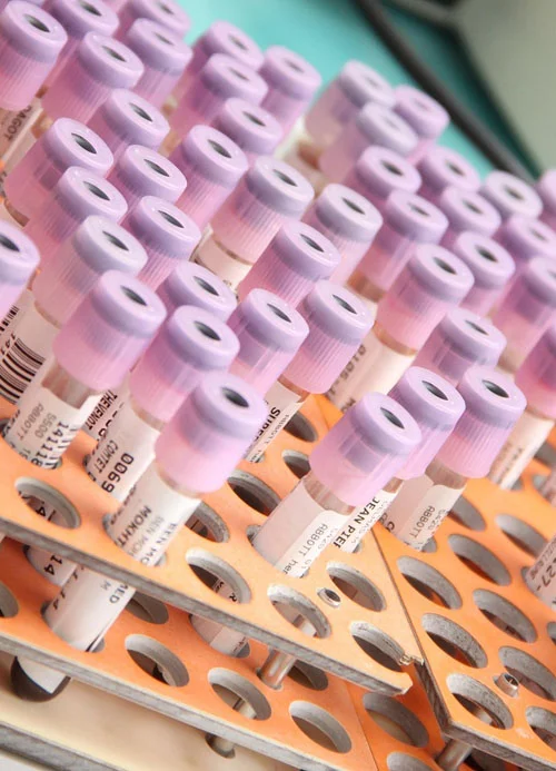 Résultats et sélection à l’oral d’admission